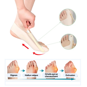 Vitality™ – Hallux-Valgus-Einlagen