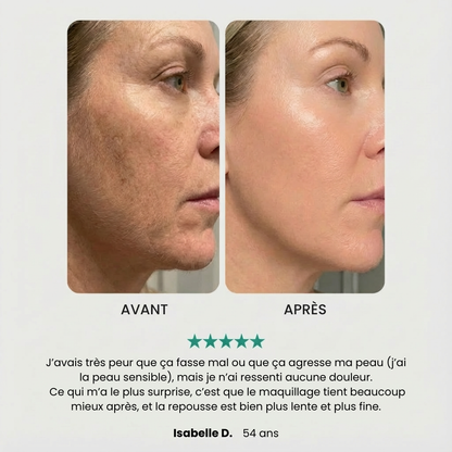 Appareil d'Épilation Précis et Indolore