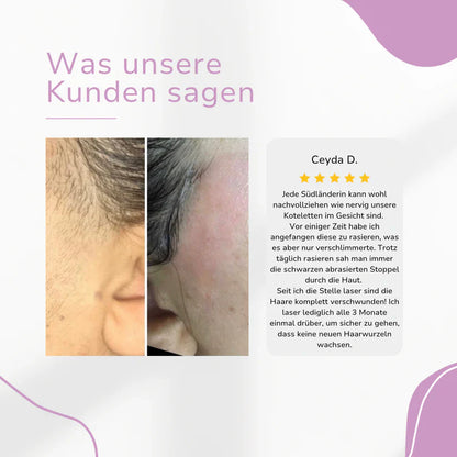 Ylvis IPL Épilateur