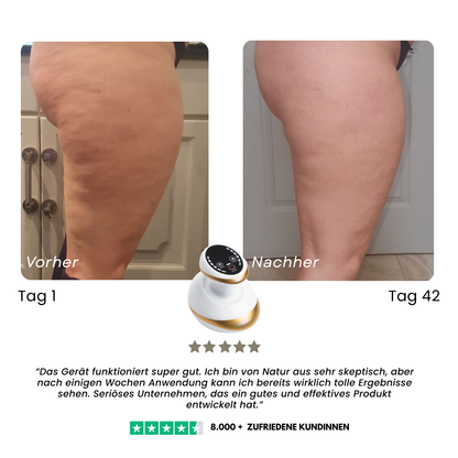 Appareil de massage anti-cellulite chauffant