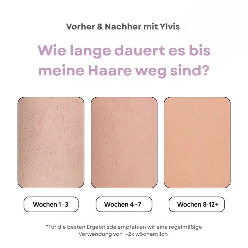 Ylvis IPL Épilateur