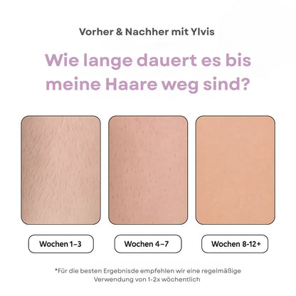 Ylvis IPL Épilateur