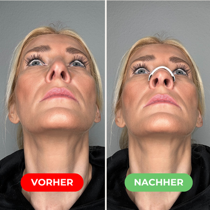 AirBreathe Pro - Original