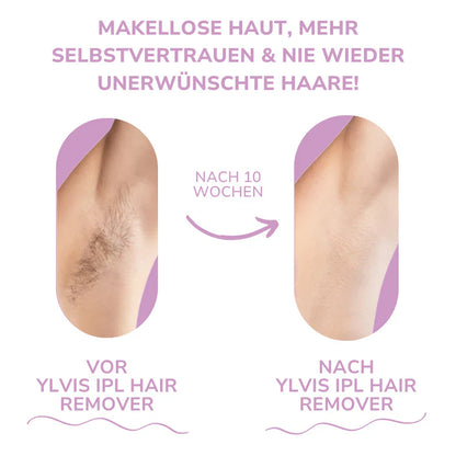 Ylvis IPL Épilateur