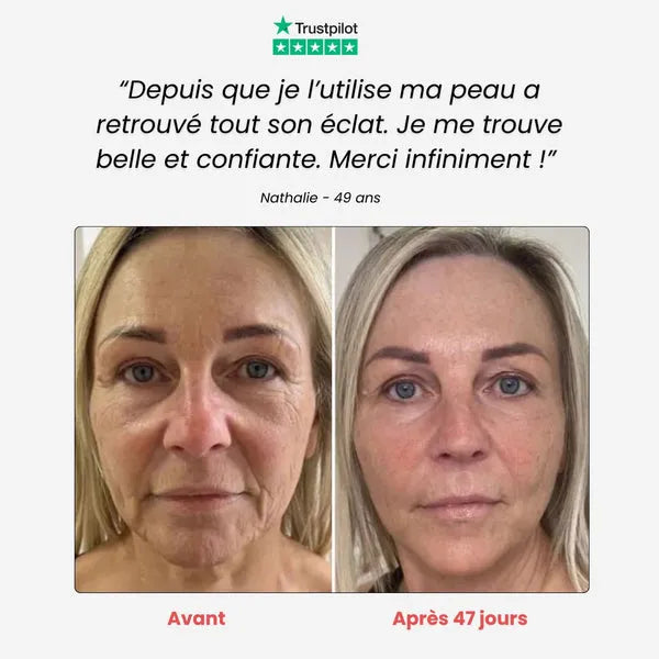 Appareil - Anti-âge