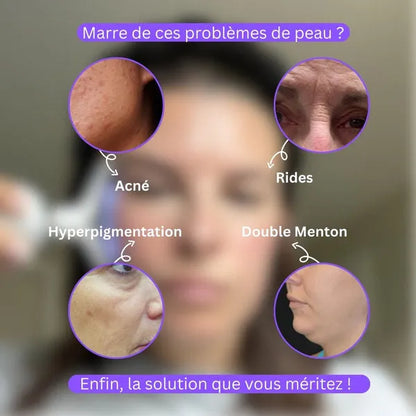 Appareil de lifting visage et cou à microvibrations